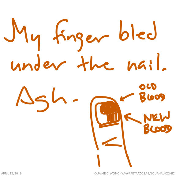 My finger bled under the nail